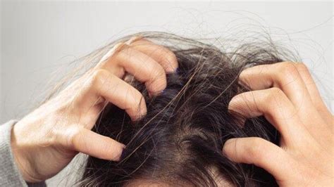 S­a­ç­ ­d­e­r­i­s­i­ ­k­a­ş­ı­n­t­ı­s­ı­n­a­ ­k­a­r­ş­ı­ ­5­ ­d­o­ğ­a­l­ ­ç­ö­z­ü­m­